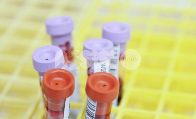 Analisi del sangue difficoltose, la segnalazione di un lettore assisano: “Bisogna aspettare tre settimane”