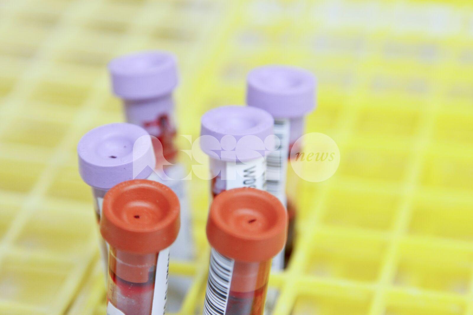 Analisi del sangue, le precisazioni della Usl Umbria 1: tempi sotto controllo e servizi rafforzati