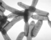 Sicurezza idrica e rischio legionella in Umbria: perché l'emergenza si previene prima dell'evento