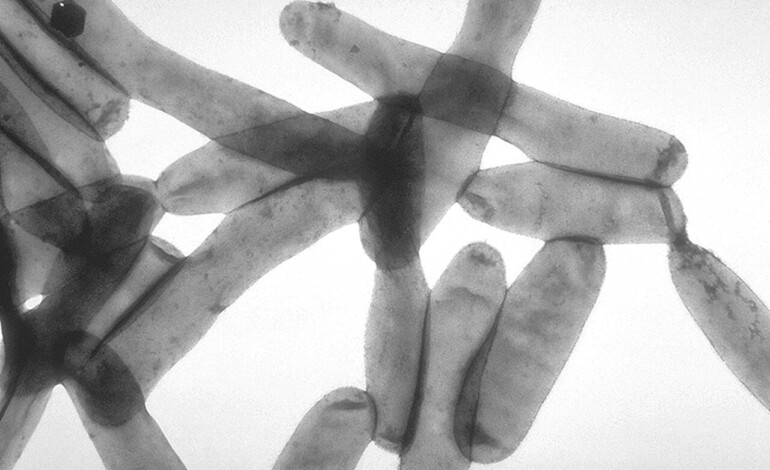 Sicurezza idrica e rischio legionella in Umbria: perché l’emergenza si previene prima dell’evento