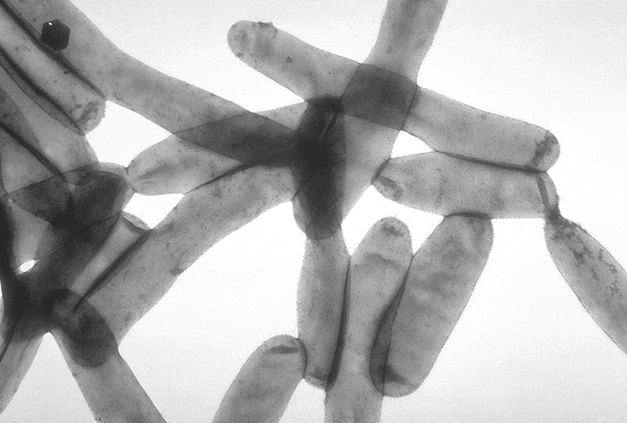Sicurezza idrica e rischio legionella in Umbria: perché l'emergenza si previene prima dell'evento